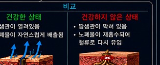 건강한 상태와 그렇지 않은 상태 비교