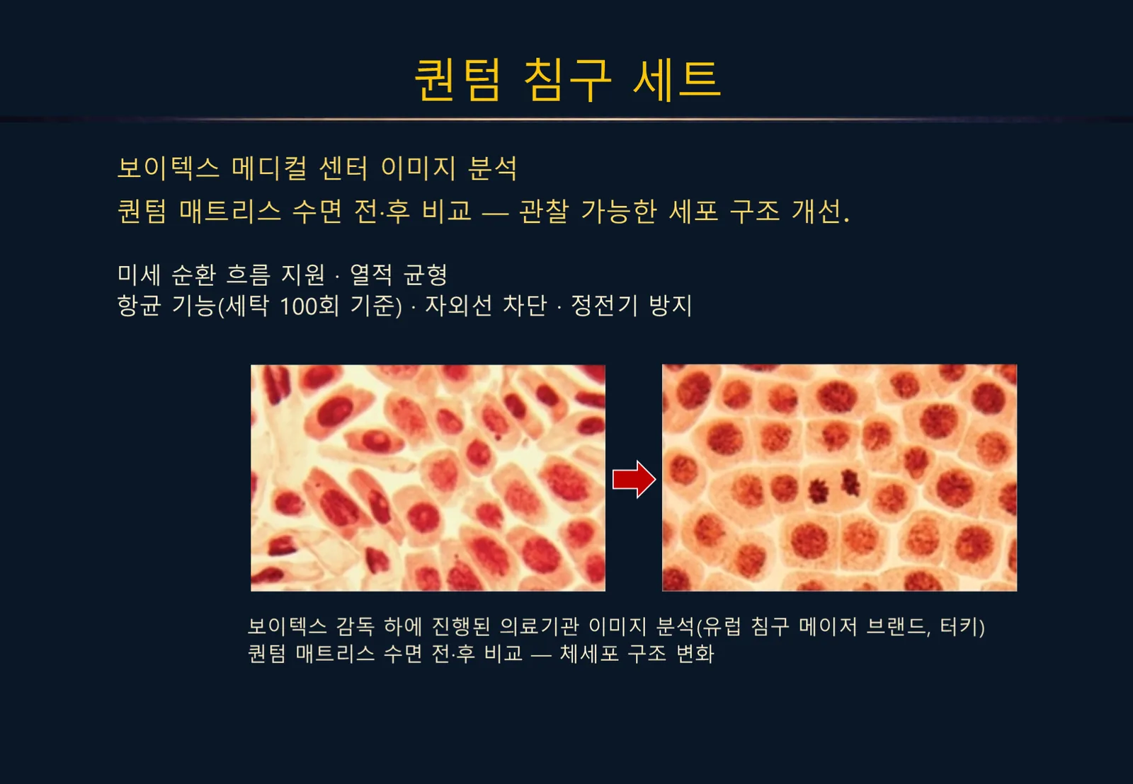 슬라이드 176